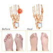 Picture of Half Toe Sleeve Pads (Dot heel)