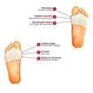 Picture of Half Toe Sleeve Pads (Dot heel)