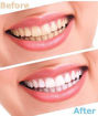 Picture of Luma  Smile