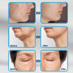 Picture of DRS Adjustable Dermastamp