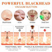 Picture of 6 in 1 Derma Suction