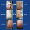 Picture of Pedi skin with USB(Pedi spin)
