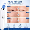Picture of Derma Suction